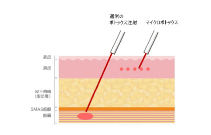 顔の適応部位